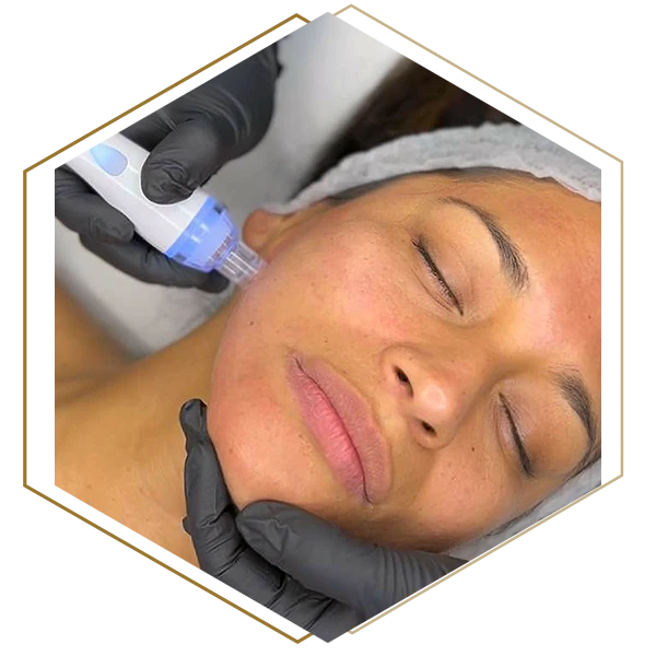 Mujer recibiendo un tratamiento de estética hydrafacial